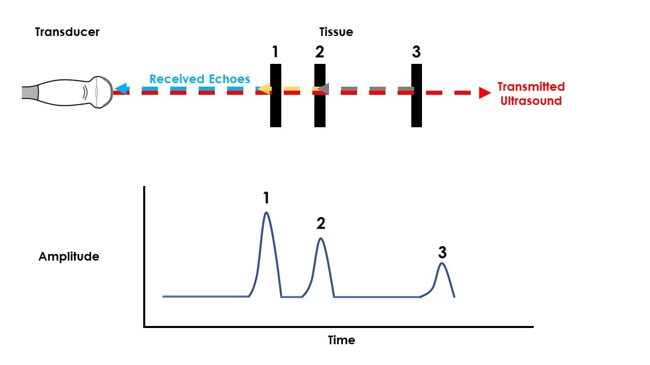 Ultrasound Modes Explained - The A, B, Ms